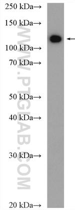 AP3D1 Antibody in Western Blot (WB)