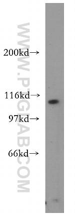 AP3D1 Antibody in Western Blot (WB)