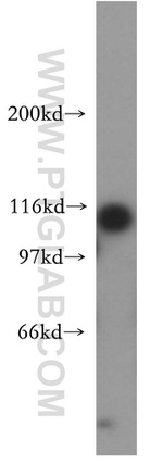 AP3D1 Antibody in Western Blot (WB)