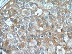 Claudin 3 Antibody in Immunohistochemistry (Paraffin) (IHC (P))