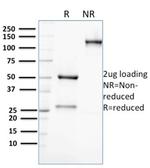 Aldo-keto Reductase Family 1 Member C2/DD2 Antibody in SDS-PAGE (SDS-PAGE)