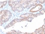 Aldo-keto Reductase Family 1 Member C2/DD2 Antibody in Immunohistochemistry (Paraffin) (IHC (P))