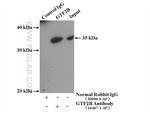 GTF2B Antibody in Immunoprecipitation (IP)