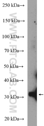 GTF2B Antibody in Western Blot (WB)