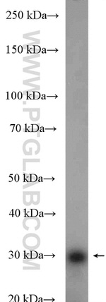 GTF2B Antibody in Western Blot (WB)