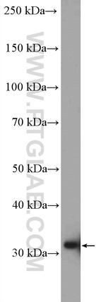 GTF2B Antibody in Western Blot (WB)