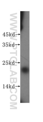 SRI Antibody in Western Blot (WB)