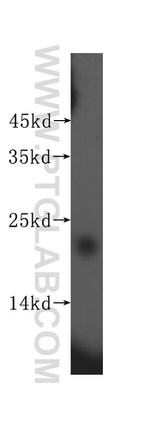 SRI Antibody in Western Blot (WB)