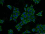 SRI Antibody in Immunocytochemistry (ICC/IF)