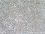 SRI Antibody in Immunohistochemistry (Paraffin) (IHC (P))