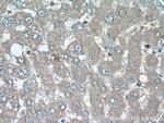 SRI Antibody in Immunohistochemistry (Paraffin) (IHC (P))