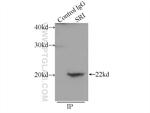 SRI Antibody in Immunoprecipitation (IP)