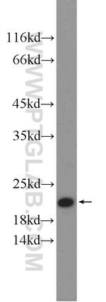 SRI Antibody in Western Blot (WB)