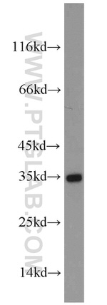 Aquaporin 4 Antibody in Western Blot (WB)