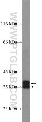 Aquaporin 4 Antibody in Western Blot (WB)