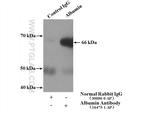 Albumin Antibody in Immunoprecipitation (IP)