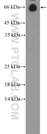 Albumin Antibody in Western Blot (WB)