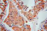 MVP/LRP Antibody in Immunohistochemistry (Paraffin) (IHC (P))