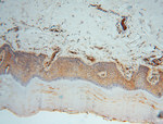 MVP/LRP Antibody in Immunohistochemistry (Paraffin) (IHC (P))