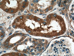 MVP/LRP Antibody in Immunohistochemistry (Paraffin) (IHC (P))