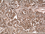 MVP/LRP Antibody in Immunohistochemistry (Paraffin) (IHC (P))