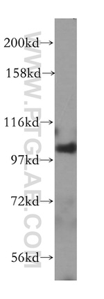 MVP/LRP Antibody in Western Blot (WB)