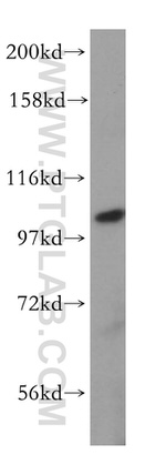 MVP/LRP Antibody in Western Blot (WB)