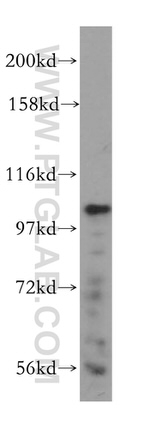 MVP/LRP Antibody in Western Blot (WB)