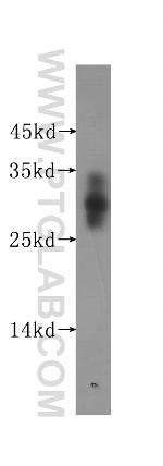 ADO Antibody in Western Blot (WB)