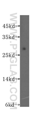 ADO Antibody in Western Blot (WB)