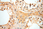 NDUFA4L2 Antibody in Immunohistochemistry (Paraffin) (IHC (P))