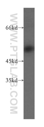 PHAX Antibody in Western Blot (WB)