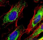 ATP5I Antibody in Immunocytochemistry (ICC/IF)