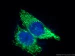 ATP5I Antibody in Immunocytochemistry (ICC/IF)