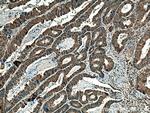 CDC25C Antibody in Immunohistochemistry (Paraffin) (IHC (P))