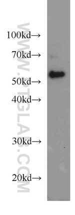 CDC25C Antibody in Western Blot (WB)