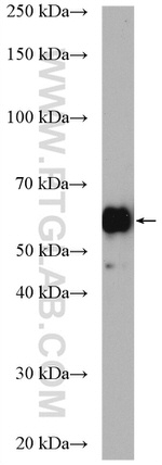 CDC25C Antibody in Western Blot (WB)