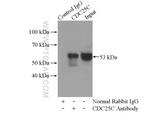 CDC25C Antibody in Immunoprecipitation (IP)