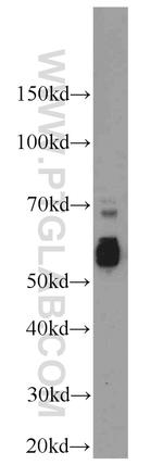 CDC25C Antibody in Western Blot (WB)