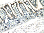 Villin Antibody in Immunohistochemistry (Paraffin) (IHC (P))