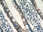 Villin Antibody in Immunohistochemistry (Paraffin) (IHC (P))