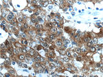 Villin Antibody in Immunohistochemistry (Paraffin) (IHC (P))