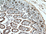 Villin Antibody in Immunohistochemistry (Paraffin) (IHC (P))