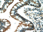 Villin Antibody in Immunohistochemistry (Paraffin) (IHC (P))