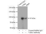 Villin Antibody in Immunoprecipitation (IP)