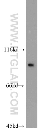 Villin Antibody in Western Blot (WB)