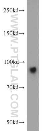 Villin Antibody in Western Blot (WB)