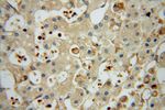 Moesin Antibody in Immunohistochemistry (Paraffin) (IHC (P))