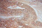 Moesin Antibody in Immunohistochemistry (Paraffin) (IHC (P))