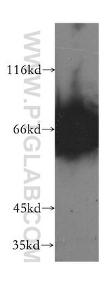 Moesin Antibody in Western Blot (WB)